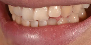 Your Perfect Smile, Made Simple